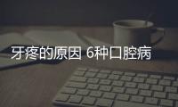 牙疼的原因 6种口腔病让老年人“疼起来真要命”